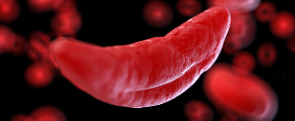anemia web.jpg