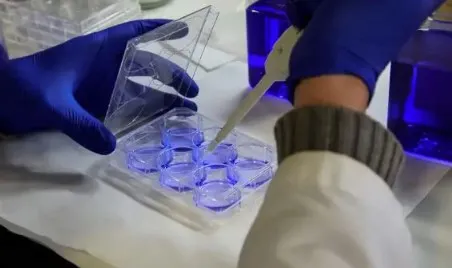 Infusión de sangre de cordón umbilical: Avances en el tratamiento de la leucemia mieloide aguda