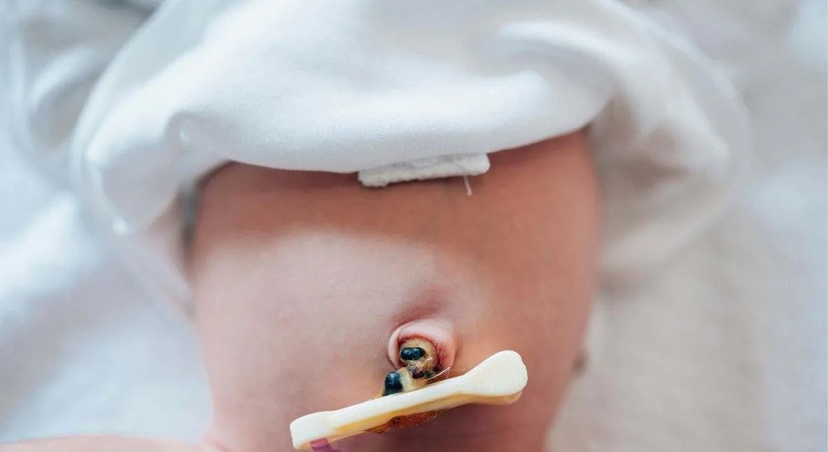 Sangre de cordón umbilical en España: trasplante, investigación y nuevas terapias celulares